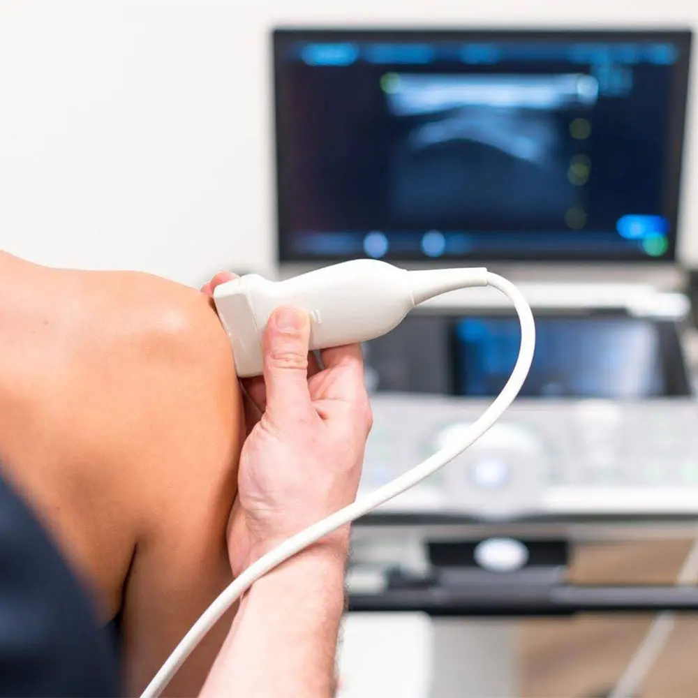 RM-Fysio-Performance-diensten-Echografie-musculosketelal-ultrasound-schouder